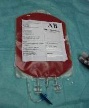 Pobrane krwiotwórcze komórki macierzyste